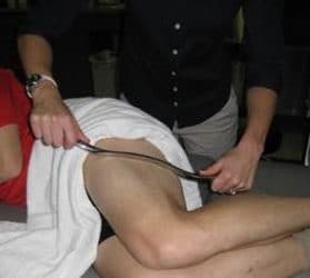 Iliotibial Band Syndrome Treatment