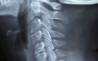 Myth: Chiropractors are not real doctors