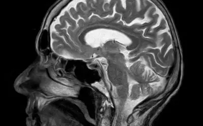 Concussion: When Should You Go to the Emergency Room?