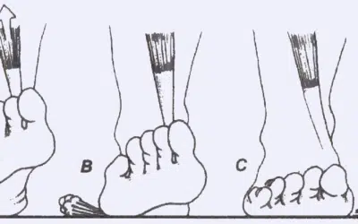 Foot Biomechanics: How You Walk Affects Everything