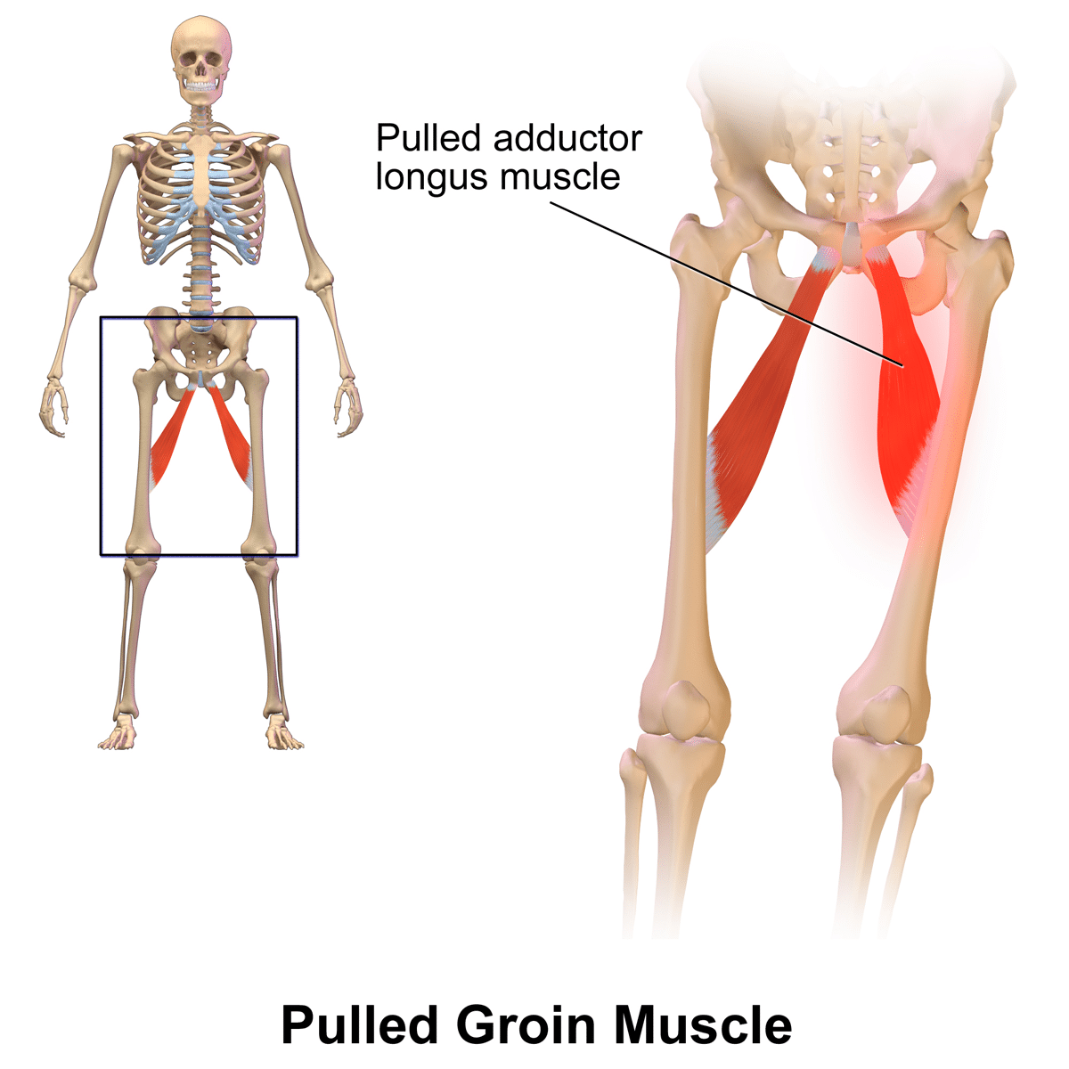 How to Relieve Groin Muscle Pain in 30 SECONDS 