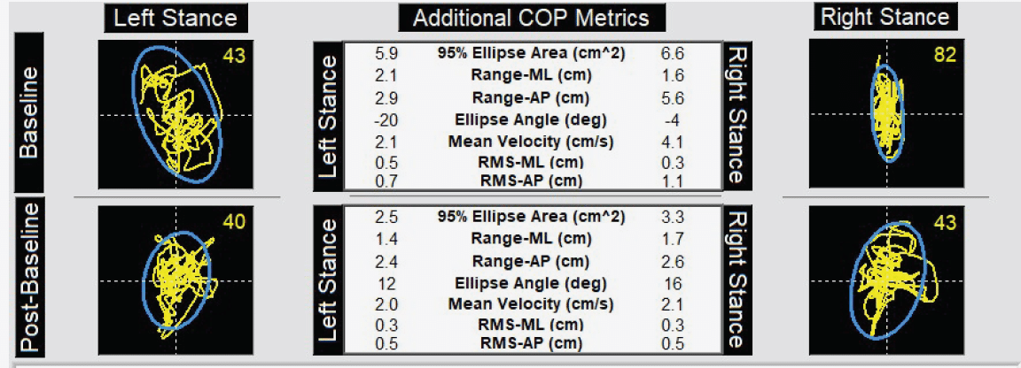 Test Your Balance with BTrackS • Harmony Chiropractic