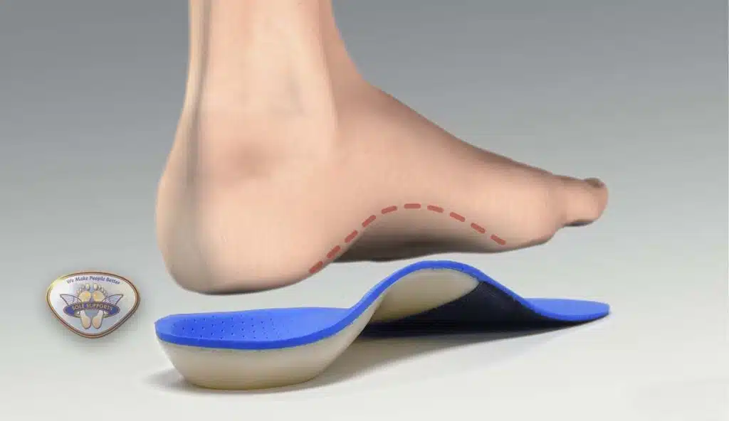 Custom foot orthotics can treat Tarsal Tunnel Syndrome