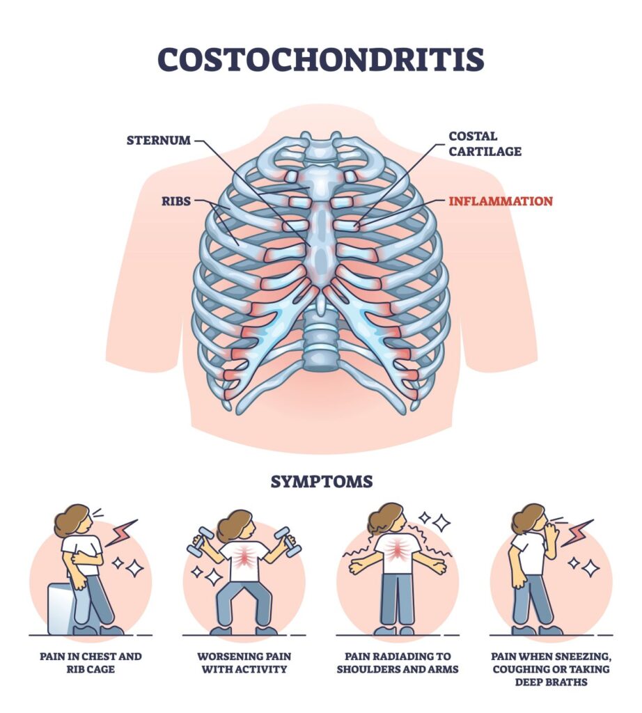 Costal Cartilage is affected by costochondritis