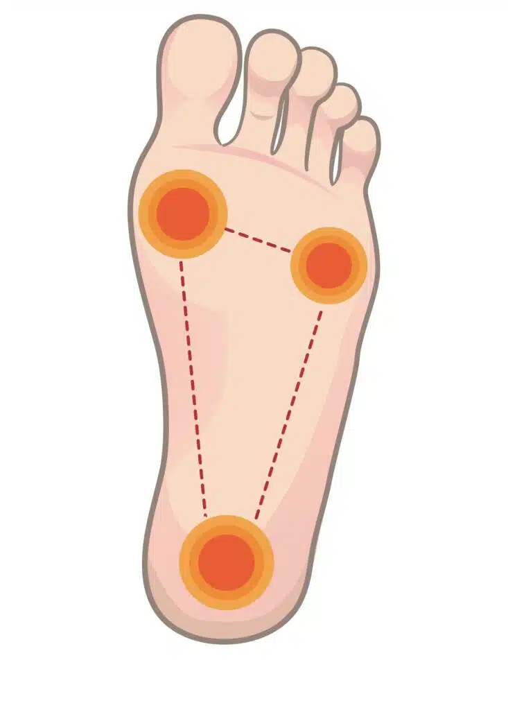 foot tripod shown on the sole of a foot